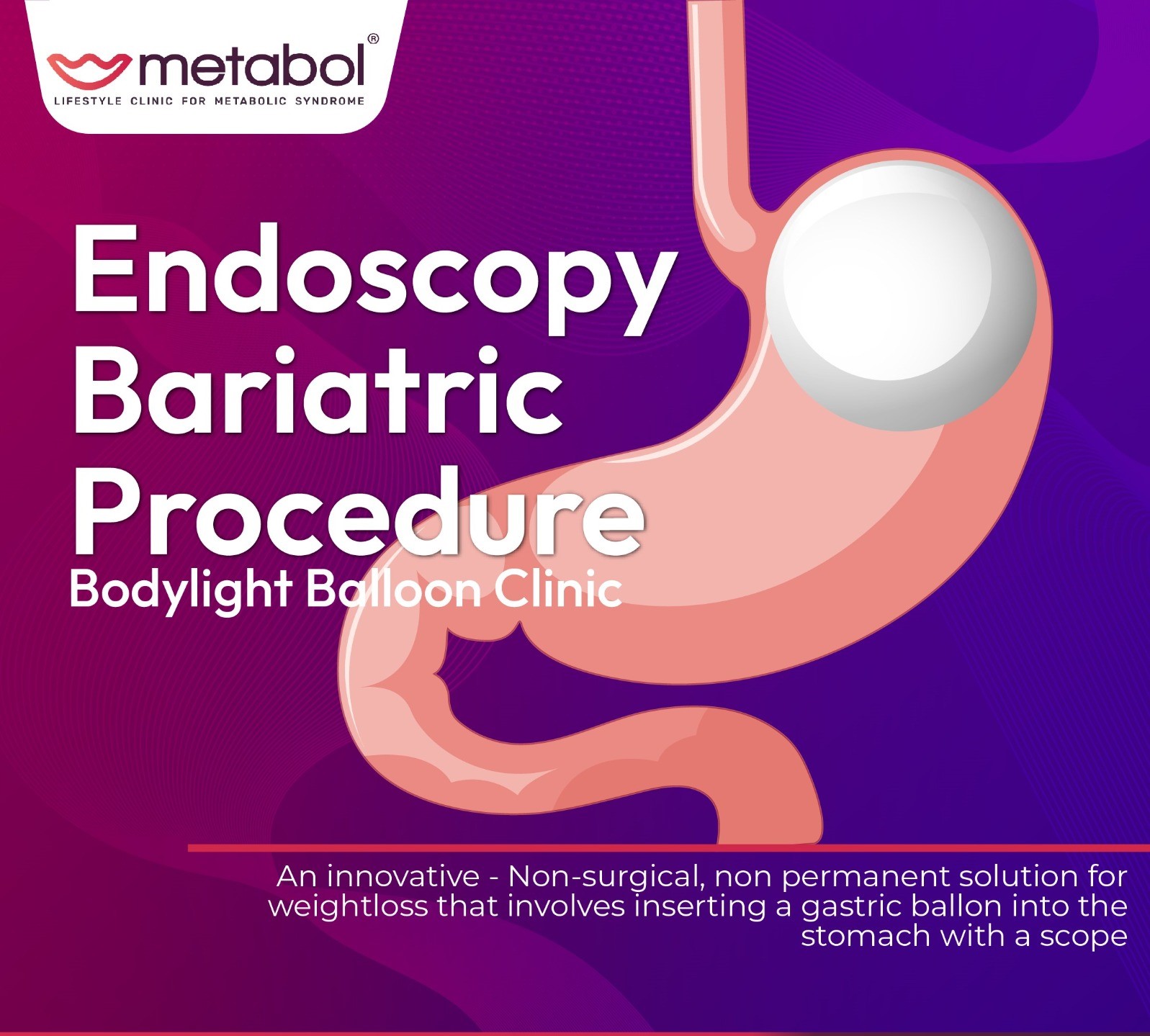 Endoscopy Bariatric Procedure